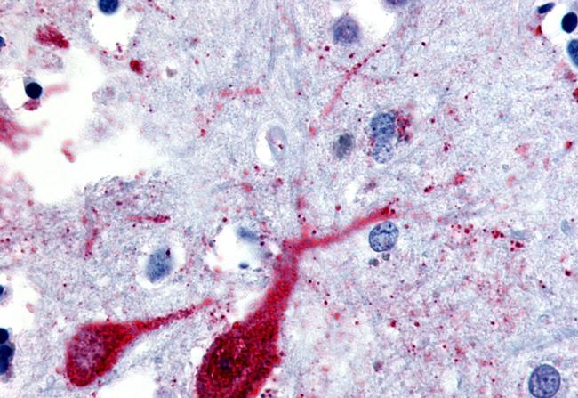 SLC5A9 Antibody in Immunohistochemistry (Paraffin) (IHC (P))