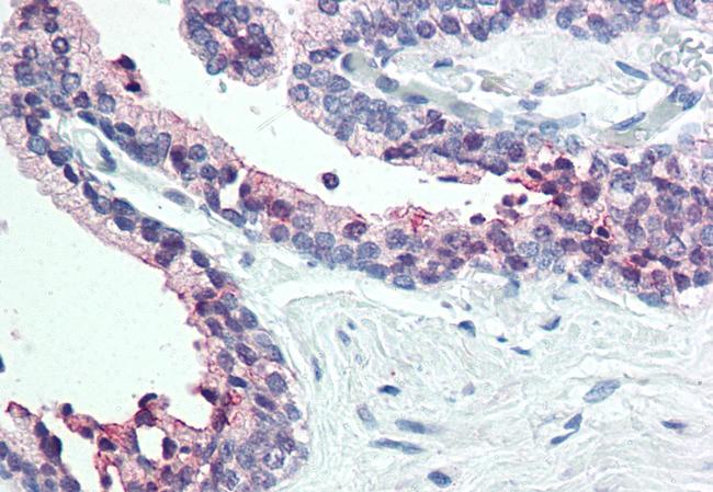 STEAP2 Antibody in Immunohistochemistry (Paraffin) (IHC (P))