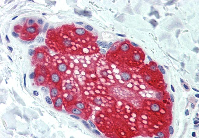 SUSD2 Antibody in Immunohistochemistry (Paraffin) (IHC (P))