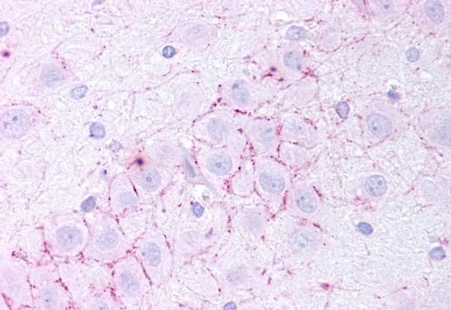 TAAR5 Antibody in Immunohistochemistry (Paraffin) (IHC (P))