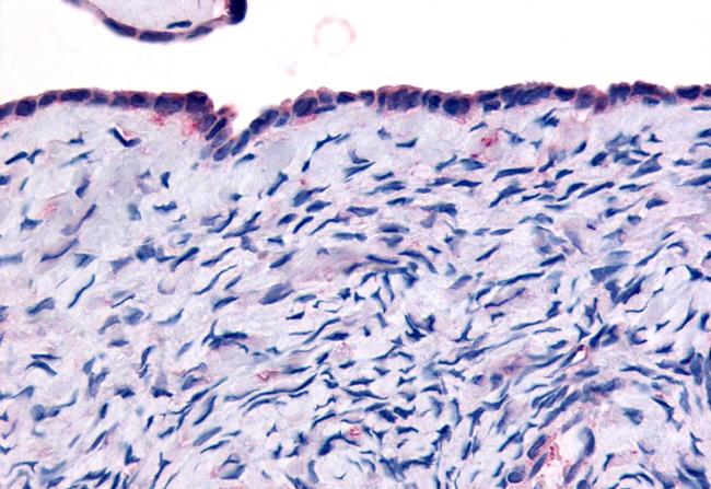 THRA Antibody in Immunohistochemistry (Paraffin) (IHC (P))