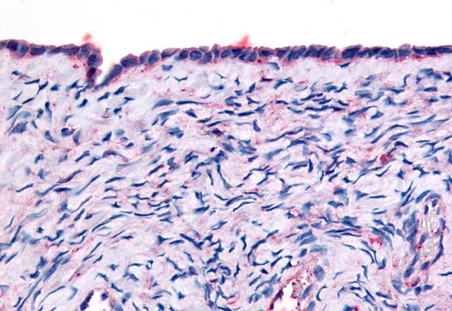 THRA Antibody in Immunohistochemistry (Paraffin) (IHC (P))