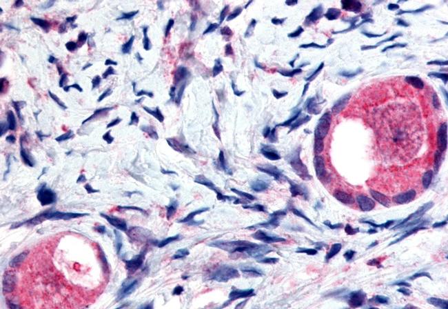 TMEM5 Antibody in Immunohistochemistry (Paraffin) (IHC (P))