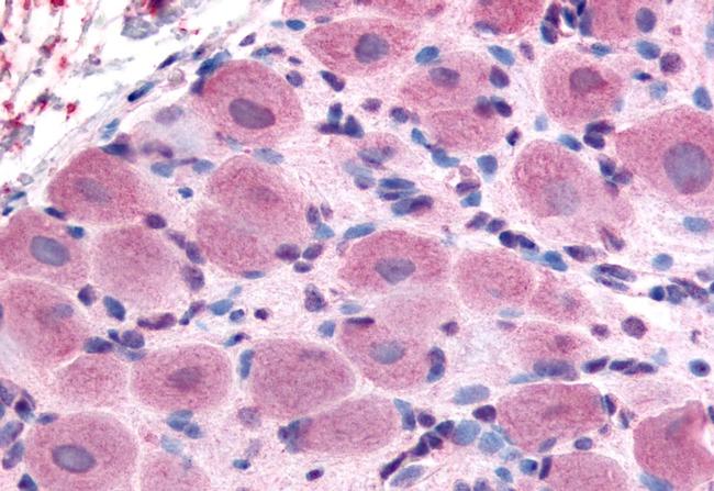 TRPA1 Antibody in Immunohistochemistry (Paraffin) (IHC (P))