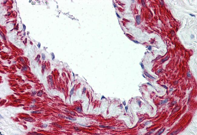 TRPM8 Antibody in Immunohistochemistry (Paraffin) (IHC (P))