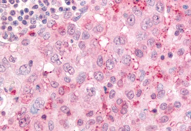 USP4 Antibody in Immunohistochemistry (Paraffin) (IHC (P))