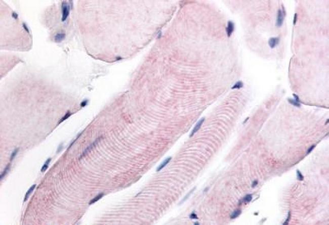 WNK1 Antibody in Immunohistochemistry (Paraffin) (IHC (P))