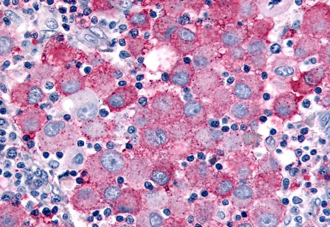 WNK1 Antibody in Immunohistochemistry (Paraffin) (IHC (P))