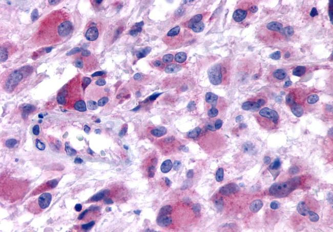 HTR2B Antibody in Immunohistochemistry (Paraffin) (IHC (P))