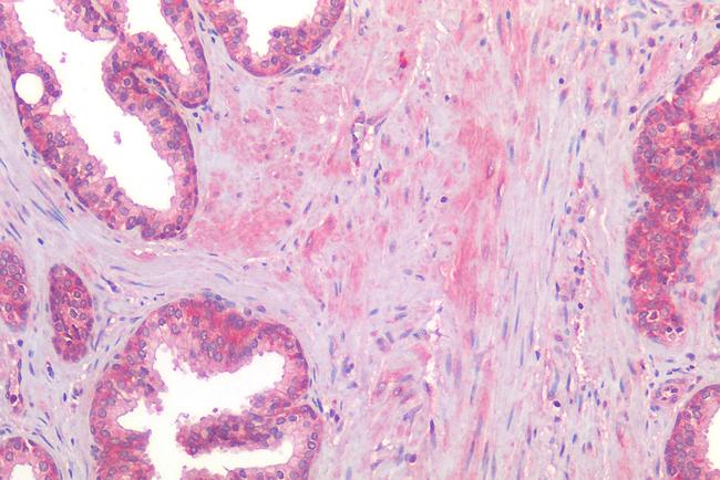 AGTR2 Antibody in Immunohistochemistry (Paraffin) (IHC (P))