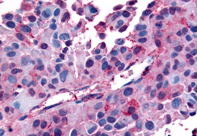 AVPR1B Antibody in Immunohistochemistry (Paraffin) (IHC (P))