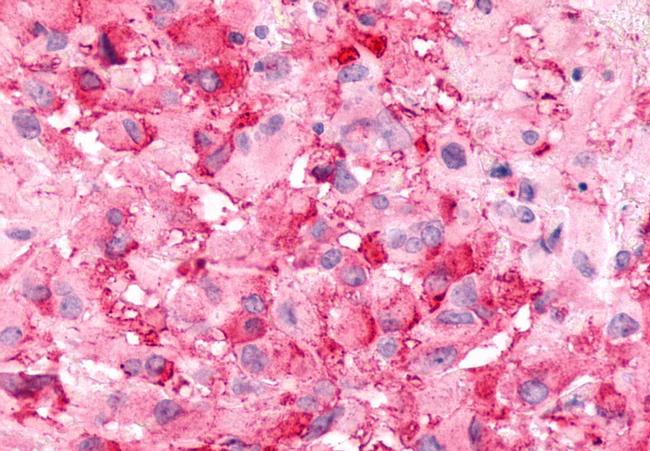 BAI2 Antibody in Immunohistochemistry (Paraffin) (IHC (P))