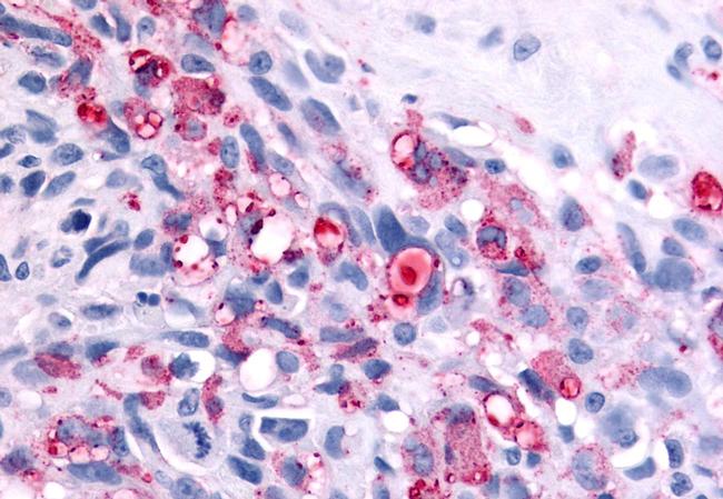 BAI2 Antibody in Immunohistochemistry (Paraffin) (IHC (P))