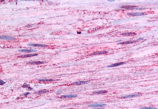 B1 Bradykinin Receptor Antibody in Immunohistochemistry (Paraffin) (IHC (P))