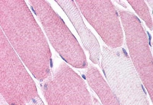 Bestrophin 3 Antibody in Immunohistochemistry (Paraffin) (IHC (P))