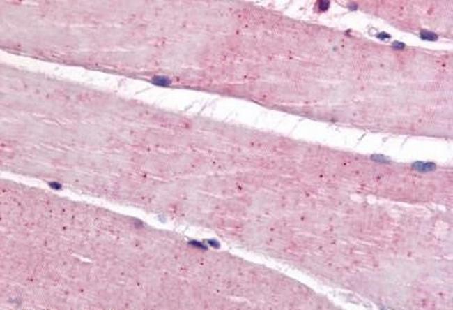 Bestrophin 3 Antibody in Immunohistochemistry (Paraffin) (IHC (P))