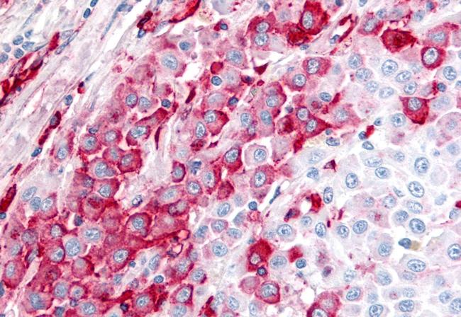 Bestrophin 4 Antibody in Immunohistochemistry (Paraffin) (IHC (P))