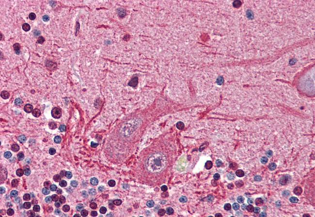 BIKE Antibody in Immunohistochemistry (Paraffin) (IHC (P))