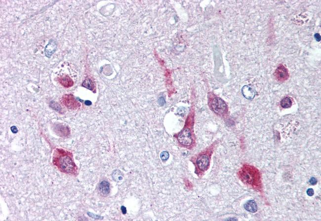 CaV1.2 Antibody in Immunohistochemistry (Paraffin) (IHC (P))