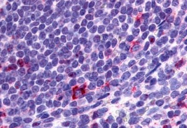 CCR2 Antibody in Immunohistochemistry (Paraffin) (IHC (P))