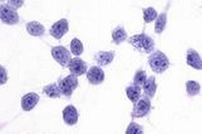 CCR7 Antibody in Immunocytochemistry (ICC/IF)