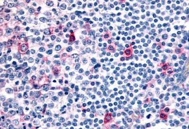 CCR8 Antibody in Immunohistochemistry (Paraffin) (IHC (P))