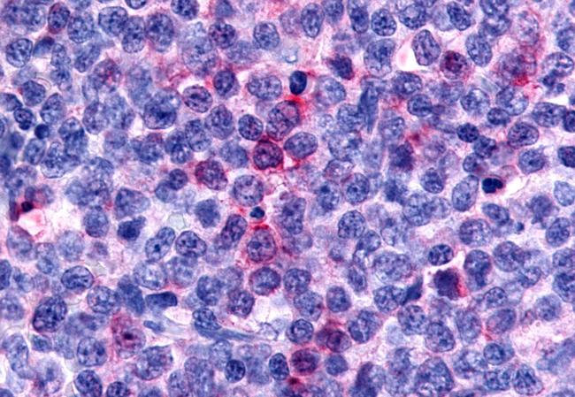 CCR8 Antibody in Immunohistochemistry (Paraffin) (IHC (P))