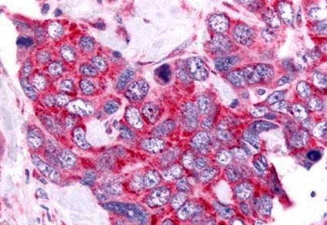 Cdc7 Antibody in Immunohistochemistry (Paraffin) (IHC (P))