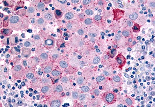 Cdc7 Antibody in Immunohistochemistry (Paraffin) (IHC (P))