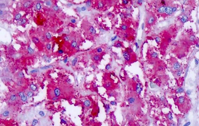 CELSR1 Antibody in Immunohistochemistry (Paraffin) (IHC (P))