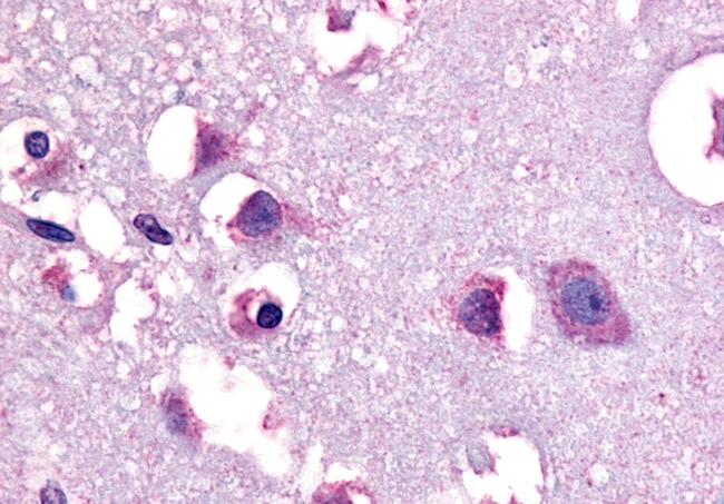 CRHR1 Antibody in Immunohistochemistry (Paraffin) (IHC (P))