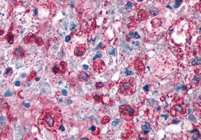 CRHR2 Antibody in Immunohistochemistry (Paraffin) (IHC (P))