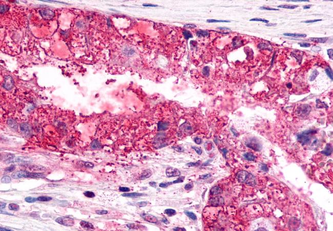 CXCR6 Antibody in Immunohistochemistry (Paraffin) (IHC (P))