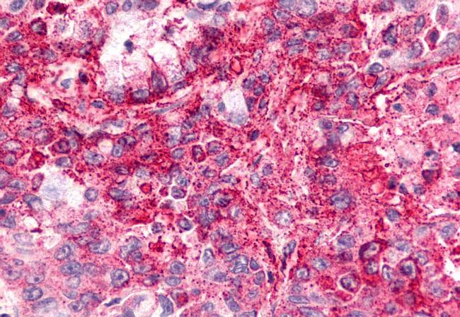 CXCR6 Antibody in Immunohistochemistry (Paraffin) (IHC (P))