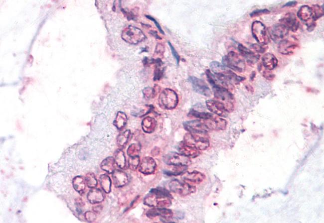 NR0B1 Antibody in Immunohistochemistry (Paraffin) (IHC (P))