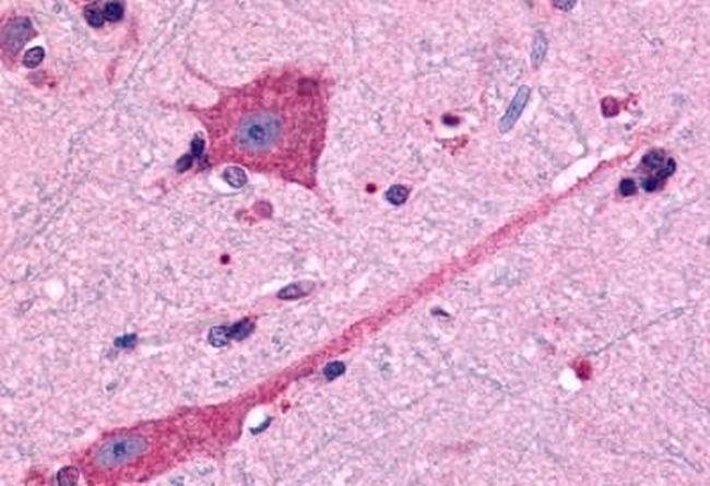 DRD2 Antibody in Immunohistochemistry (Paraffin) (IHC (P))