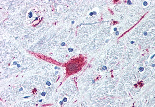 DRD3 Antibody in Immunohistochemistry (Paraffin) (IHC (P))