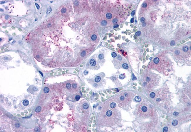 EDG3 Antibody in Immunohistochemistry (Paraffin) (IHC (P))