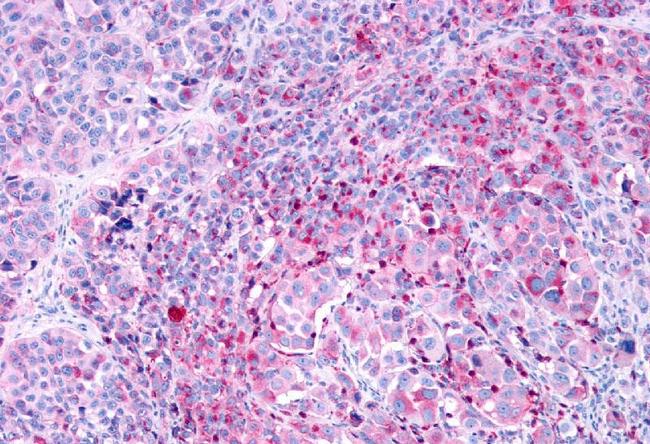 LPAR3 Antibody in Immunohistochemistry (Paraffin) (IHC (P))