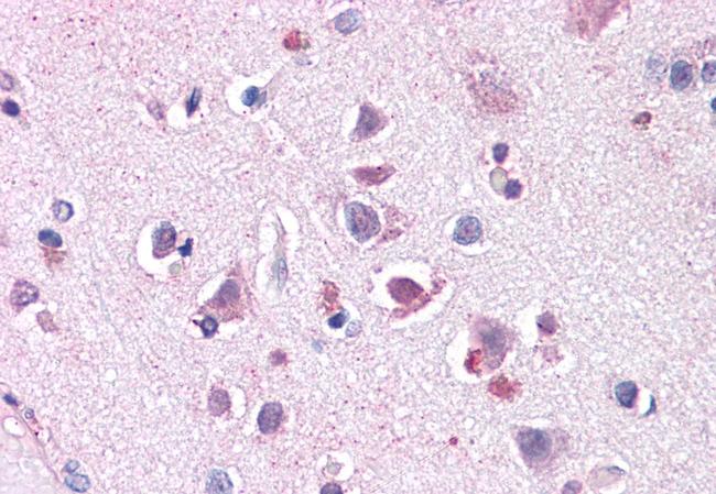 ENT1 Antibody in Immunohistochemistry (Paraffin) (IHC (P))