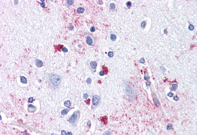 ENT1 Antibody in Immunohistochemistry (Paraffin) (IHC (P))