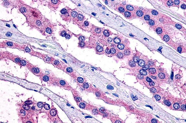 PTGER2 Antibody in Immunohistochemistry (Paraffin) (IHC (P))