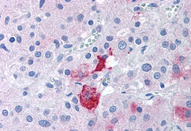 EPHX2 Antibody in Immunohistochemistry (Paraffin) (IHC (P))