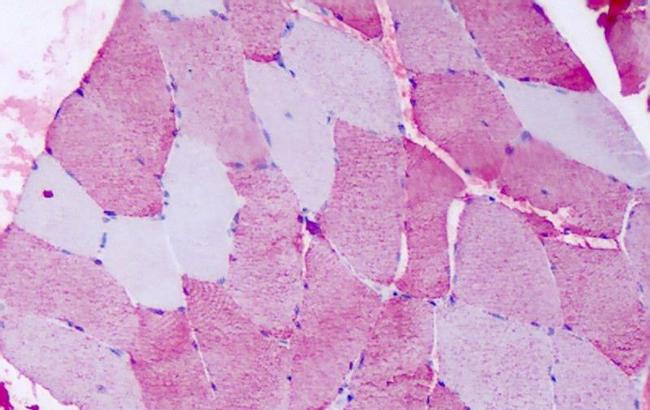 FZD6 Antibody in Immunohistochemistry (Paraffin) (IHC (P))