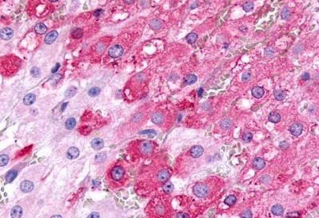 FSHR Antibody in Immunohistochemistry (Paraffin) (IHC (P))