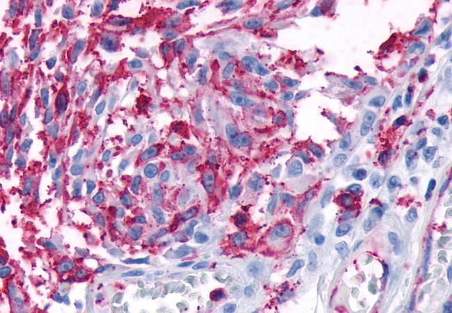 FZD3 Antibody in Immunohistochemistry (Paraffin) (IHC (P))