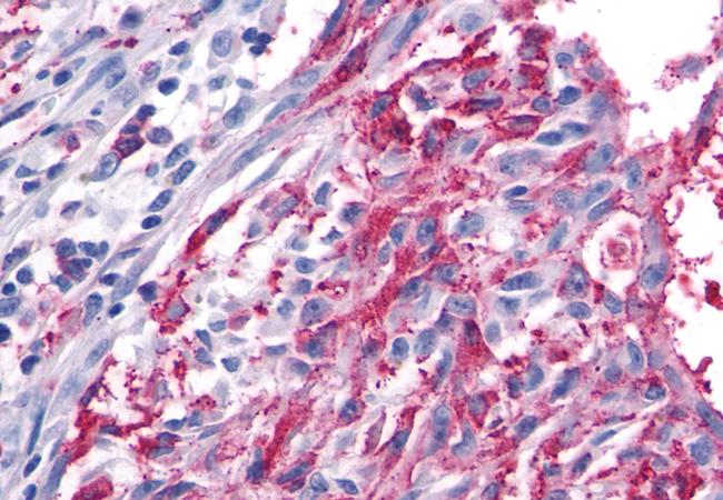 FZD5 Antibody in Immunohistochemistry (Paraffin) (IHC (P))