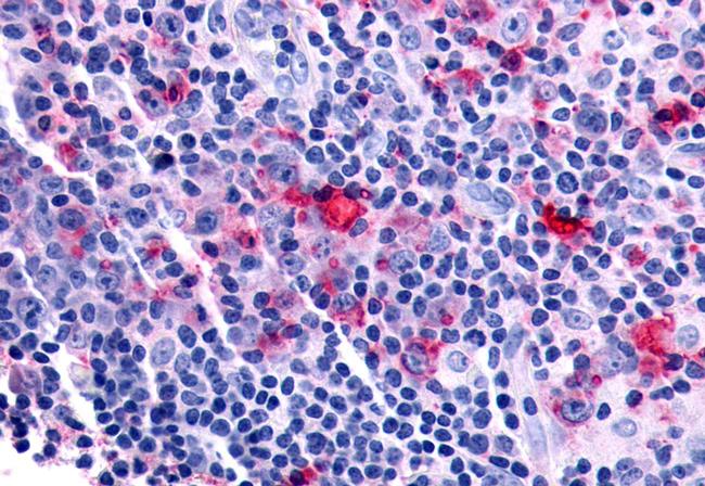 FZD8 Antibody in Immunohistochemistry (Paraffin) (IHC (P))