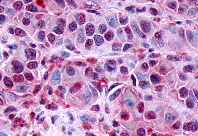 FZD8 Antibody in Immunohistochemistry (Paraffin) (IHC (P))