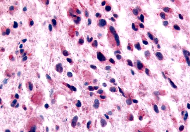 GABBR1 Antibody in Immunohistochemistry (Paraffin) (IHC (P))